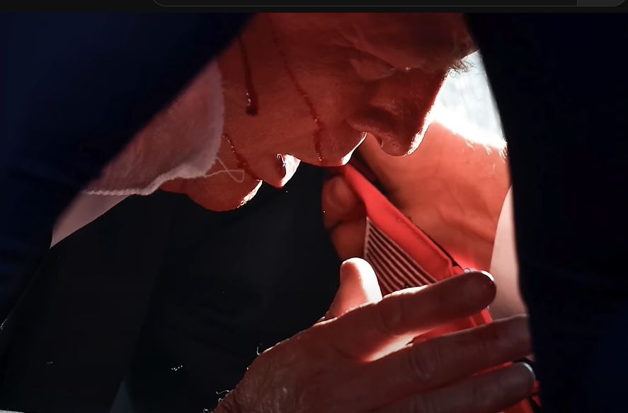 Trump s krví na uchu a ruce